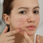 The Best Skincare Routine for Oily Skin